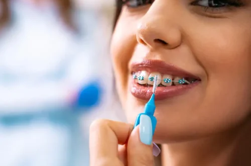 How Braces Can Fix Bite Issues And Jaw Pain